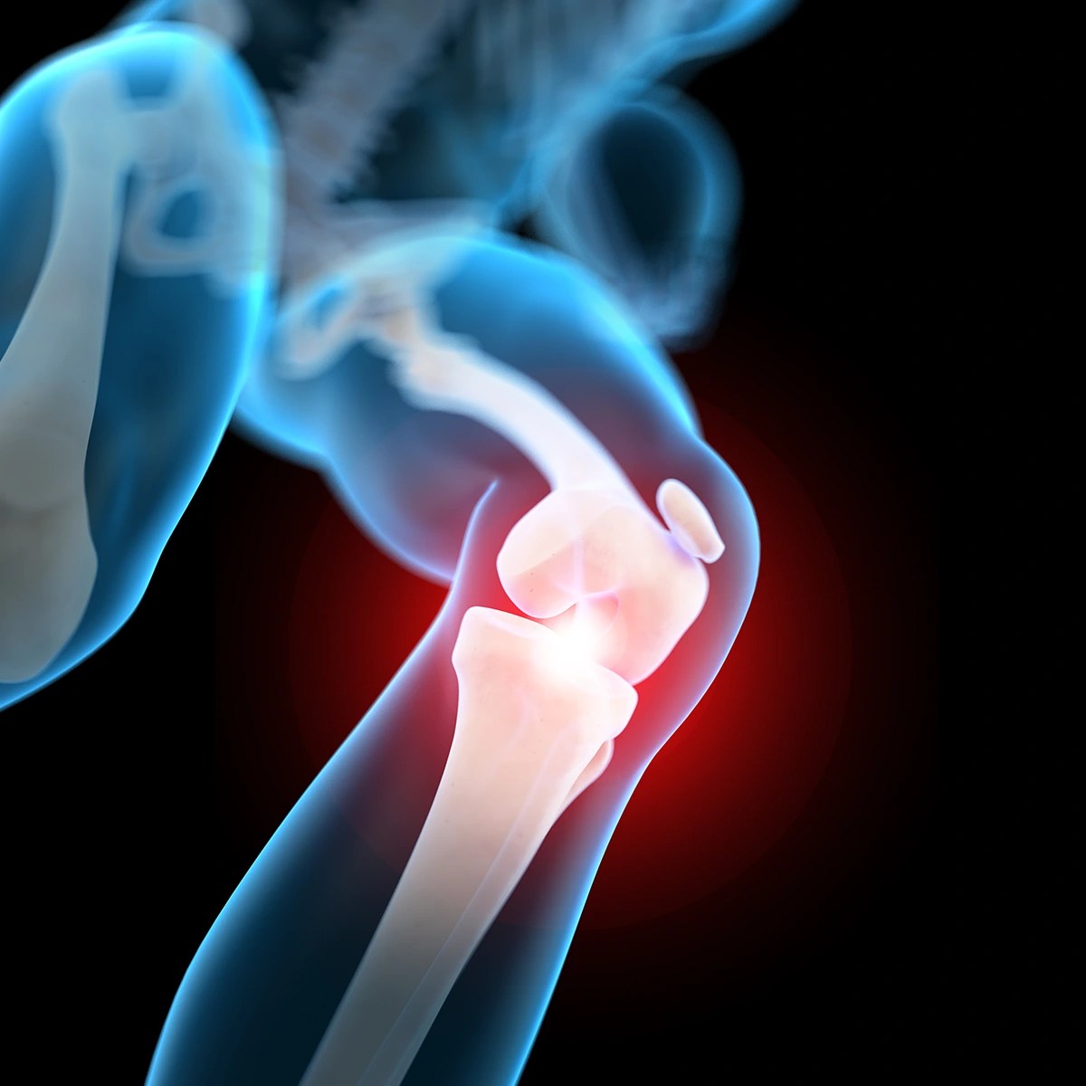 Knee Pain Causes and Treatments • Dr. Paul Miano