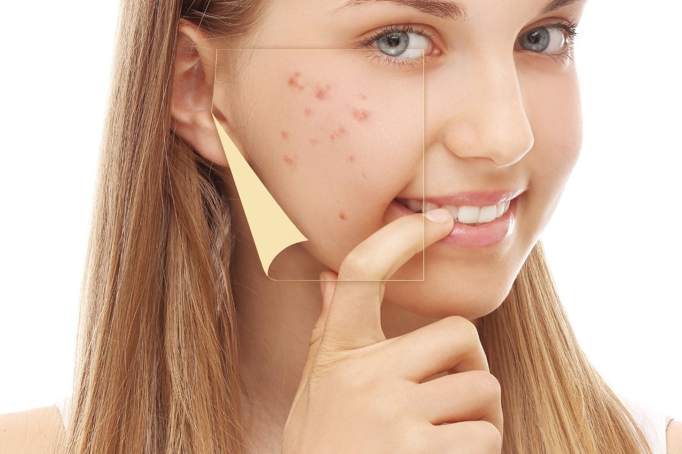 The Skin Cycle & Your Period Why You Break Out During PMS Dr