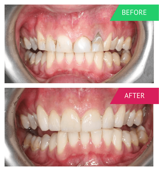 Cosmetic Dentist Adelaide Dr Zielinski & Associates