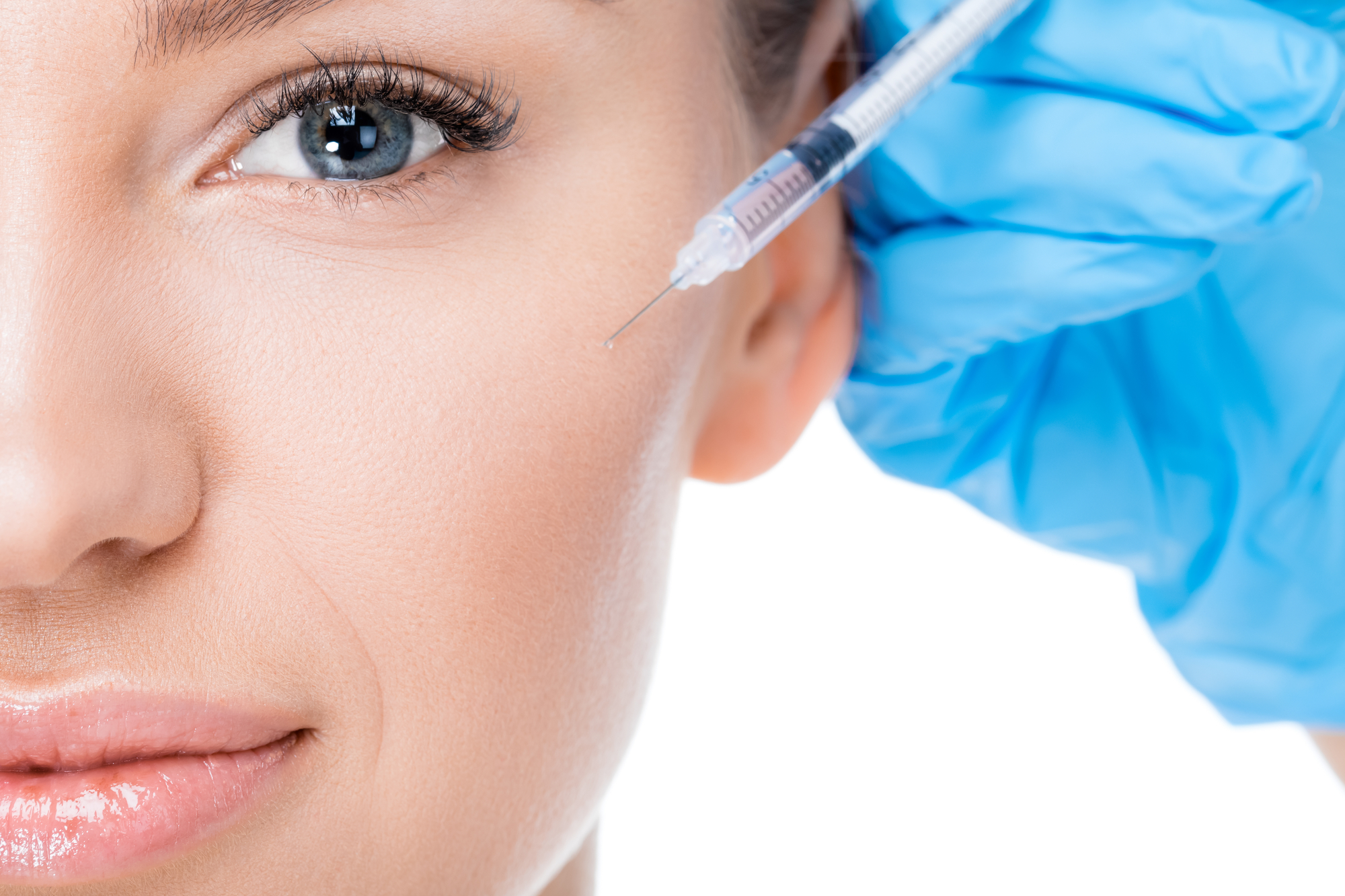 Botox para Migrañas ¿Cómo Funciona el Tratamiento? drnashcares