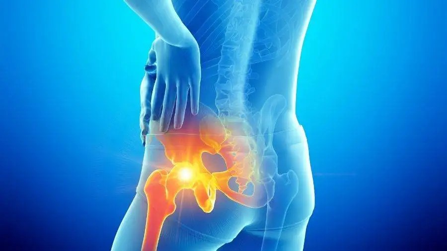 Finding the Best Hip Replacement Surgeon for Total and Partial Hip