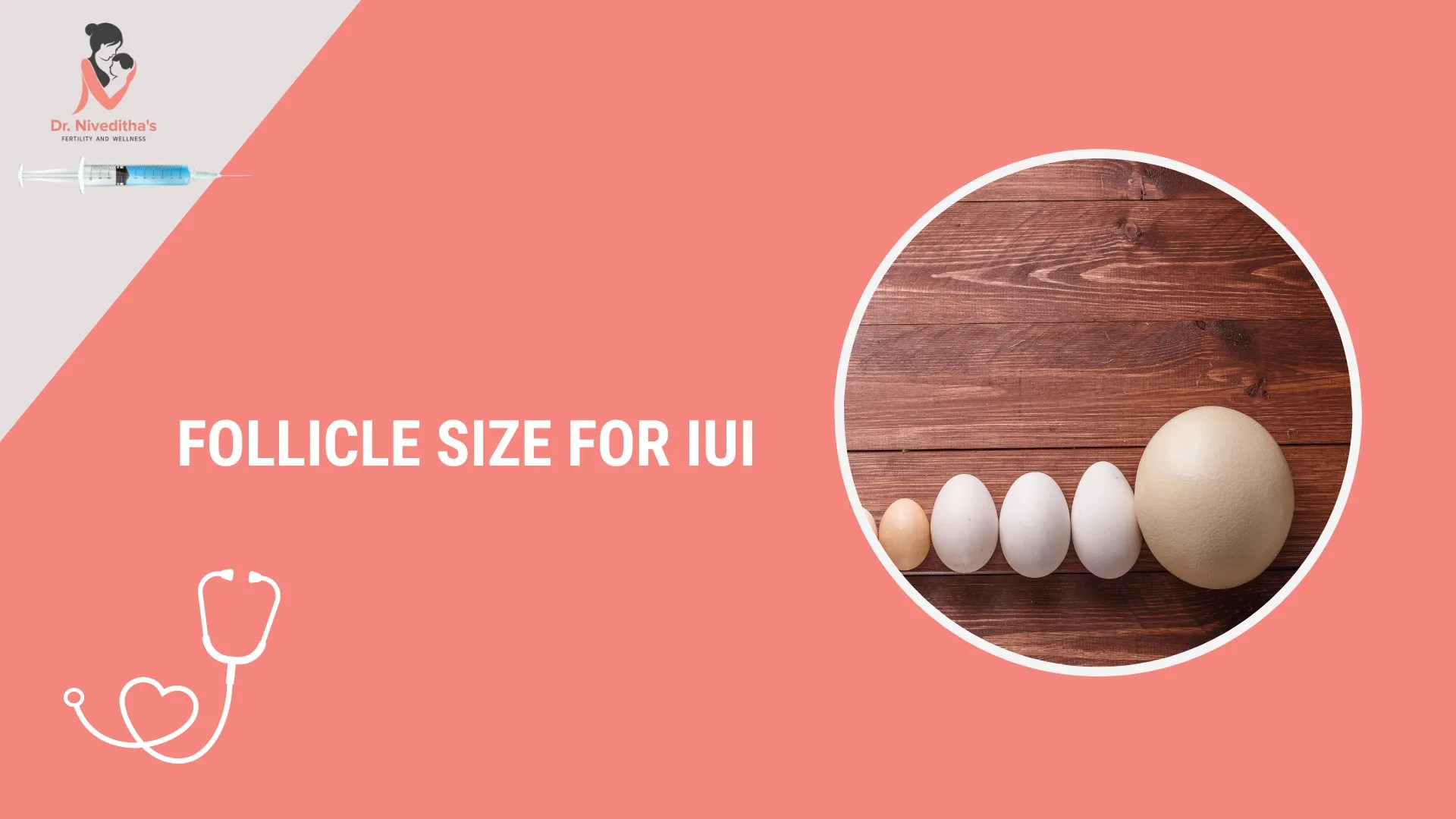 Dos And Don'ts After Embryo Transfer For Successful IVF