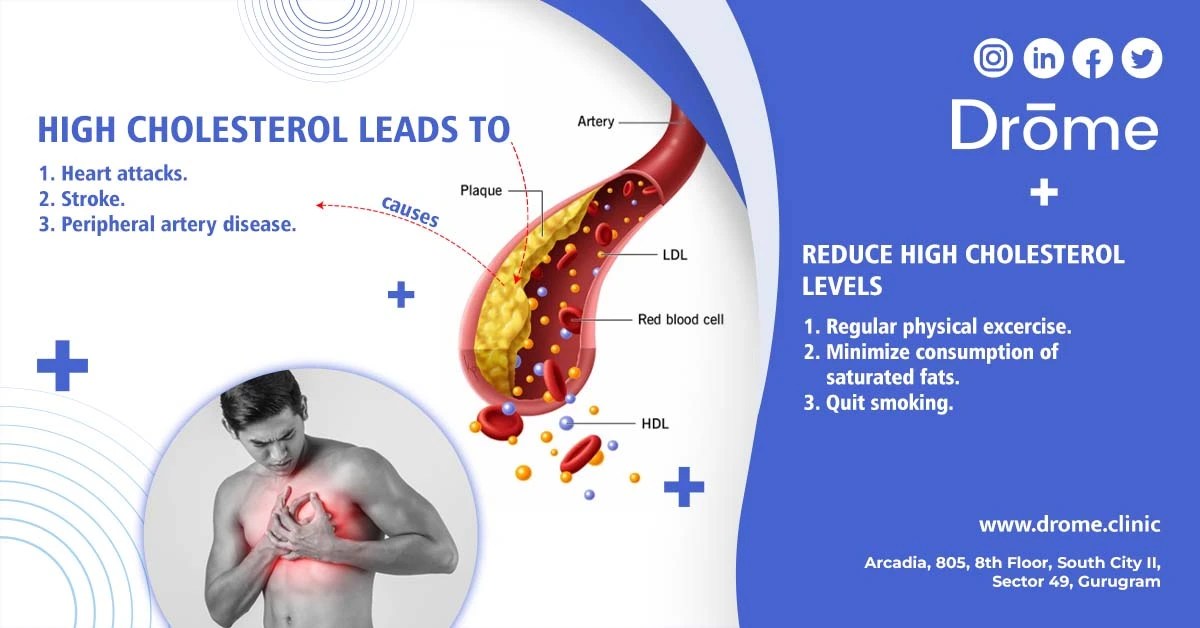 Hyperlipidemia (High Cholesterol) causes, symptoms and prevention