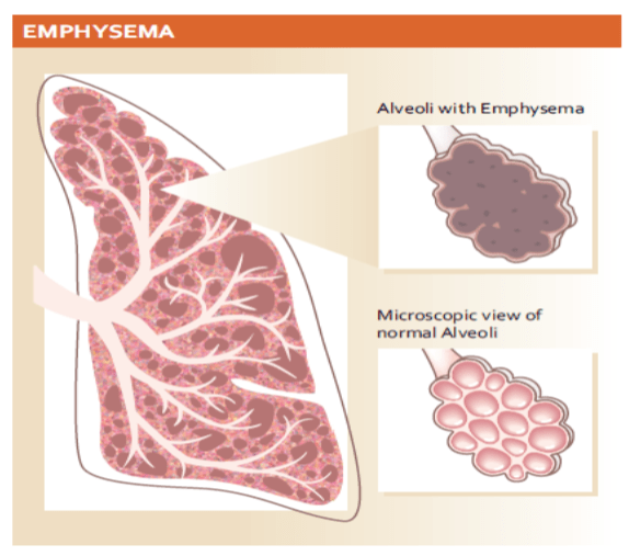 COPD Doctor in Borivali Dr Parthiv Shah Call for Consultation