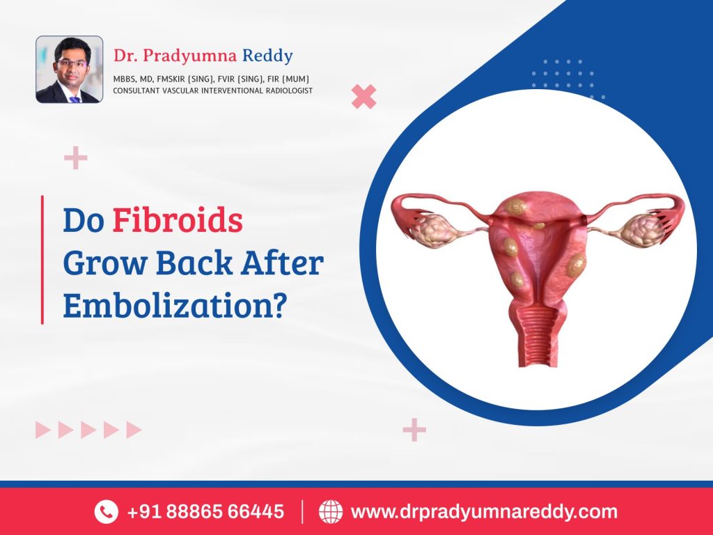 Do Fibroids Grow Back After Embolization?