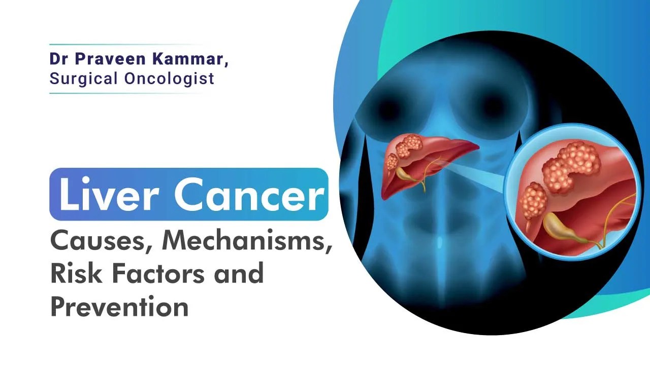 Liver Cancer Causes, Mechanisms, Risk Factors, and Prevention