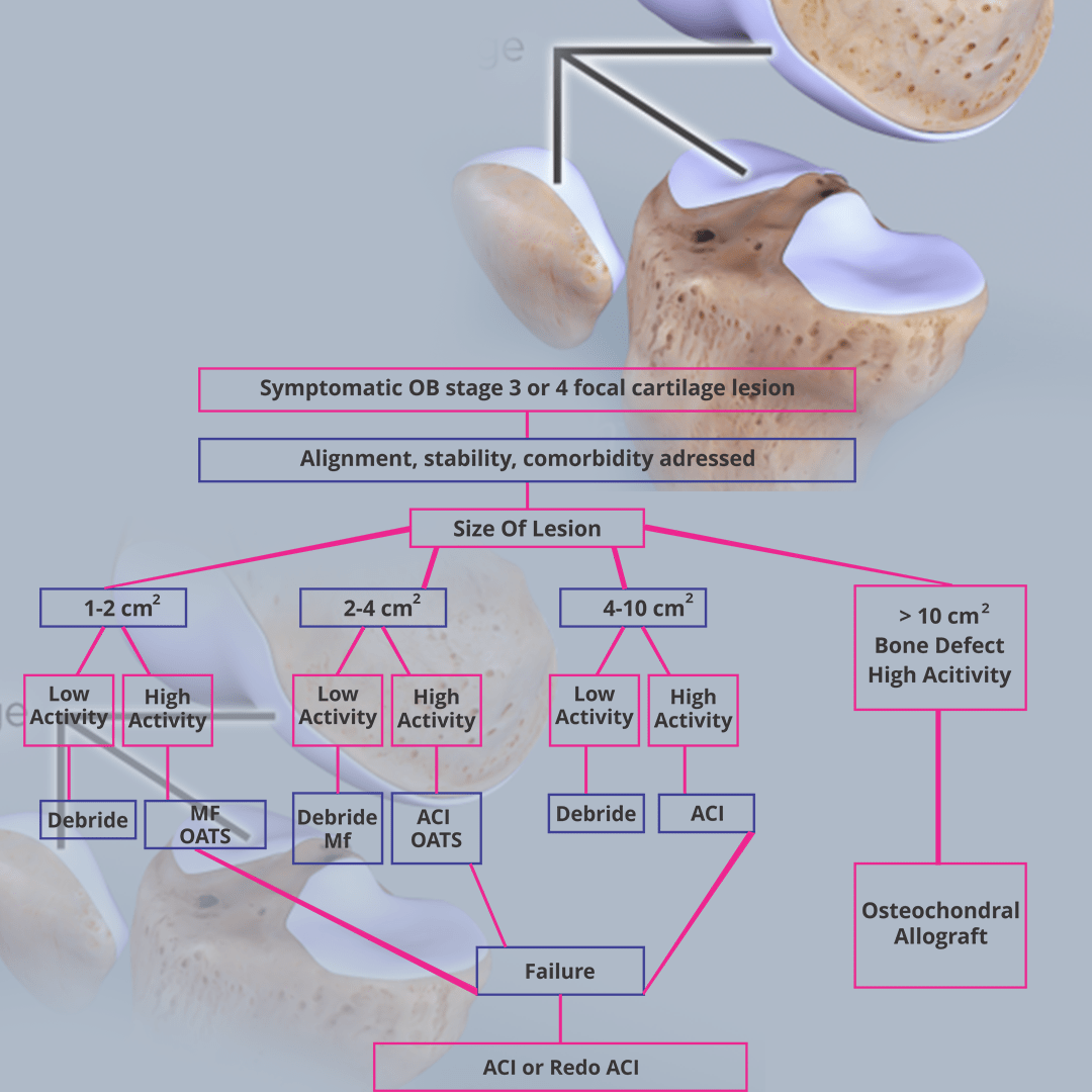 Chondral Defect of the Knee Rajesh Bhalla