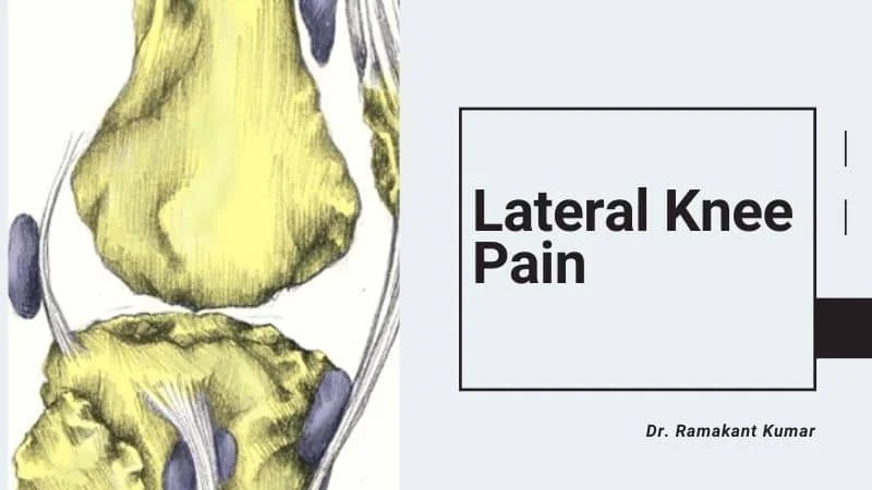 Lateral Knee Pain [Treatment & Exercises] Dr. Ramakant