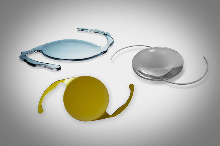 Advancements in Cataract Intraocular Lens (IOL) Technology