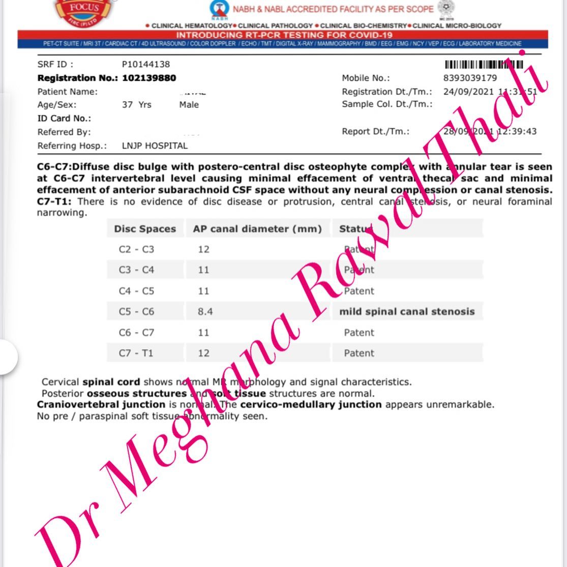 Spinal Cord Tumor ( Neoplasm) Treatment 6 Months Dr Rawal Dr Rawal Thali