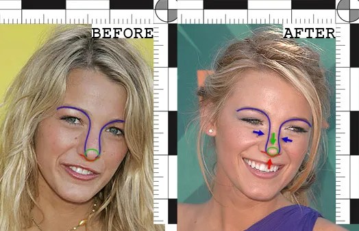 Blake Lively Didn’t Need A Nose Job To Be Famous