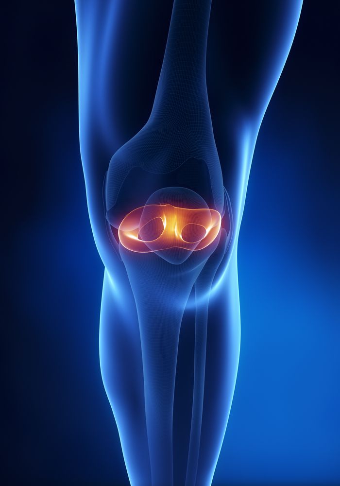 Meniscal Transplant Sports Medicine Knee Specialist Minnesota
