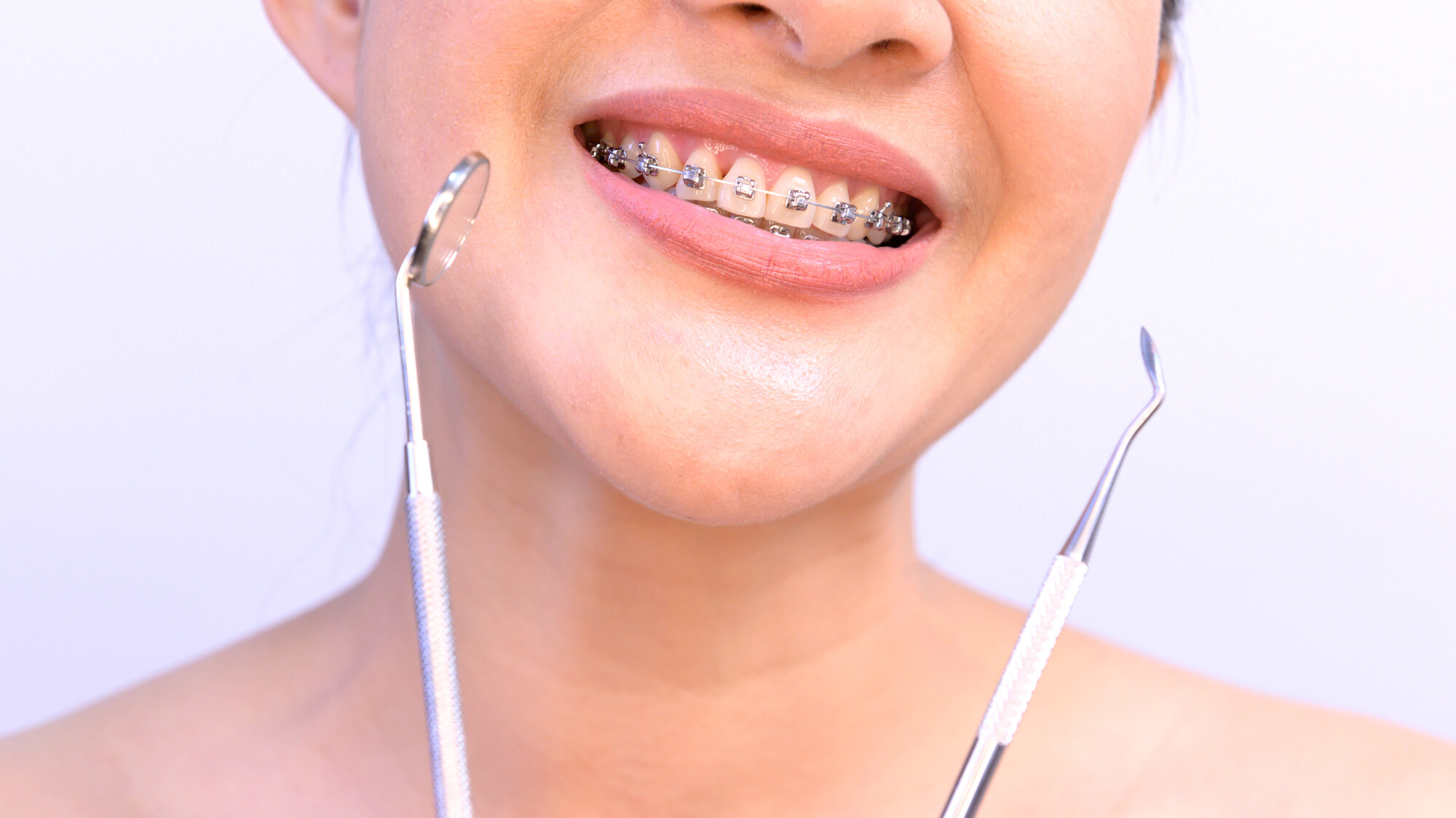 7 Tips for Choosing an Orthodontic Practice for Your Child