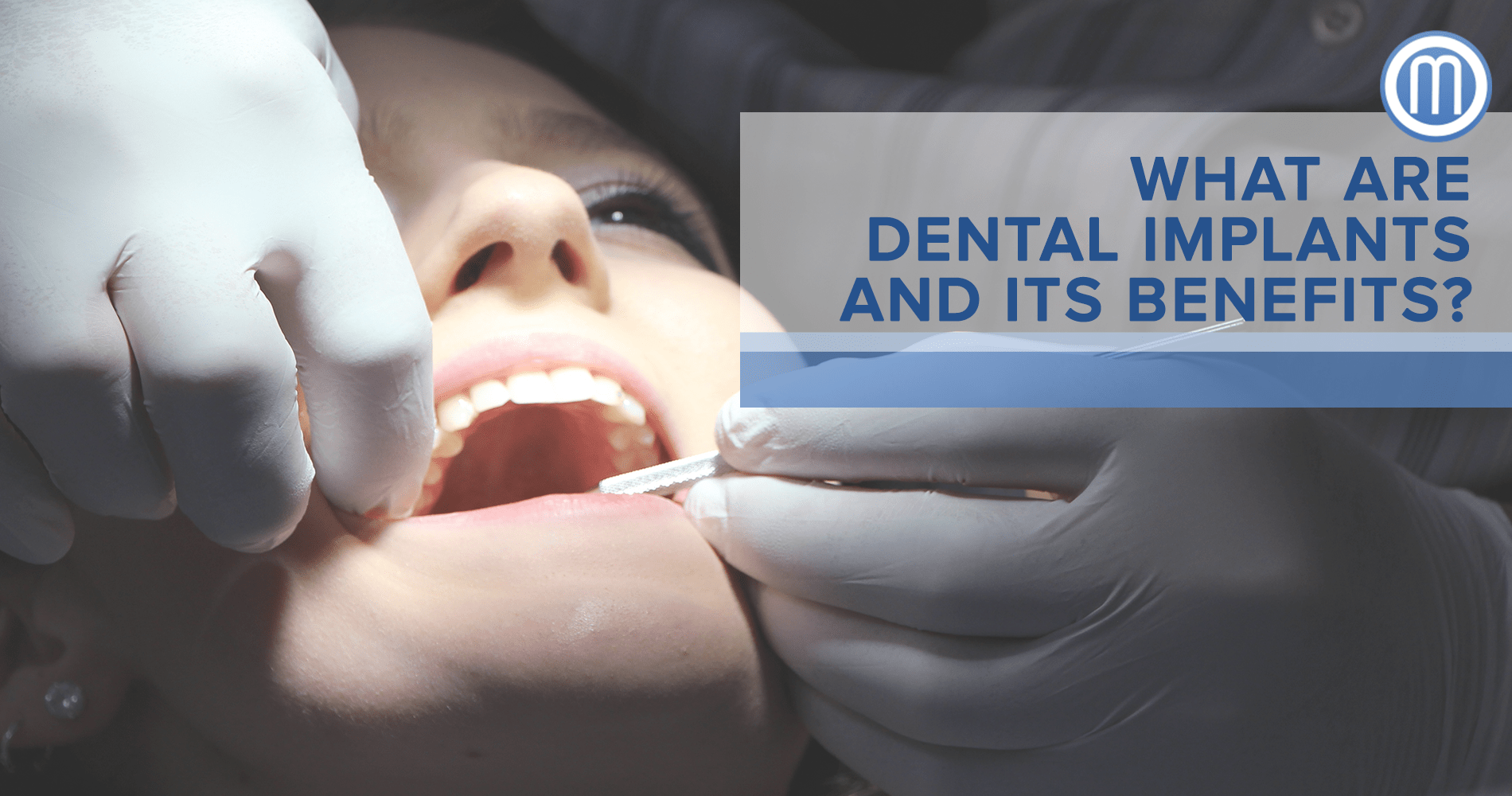 What Are Dental Implants And Its Benefits? Dr Rowena Marzo Esthetic and Dental Implants Makati