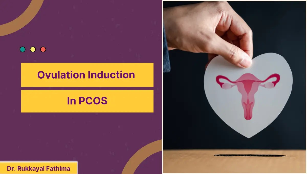 Ovulation Induction In PCOS Dr. Rukkayal Fathima