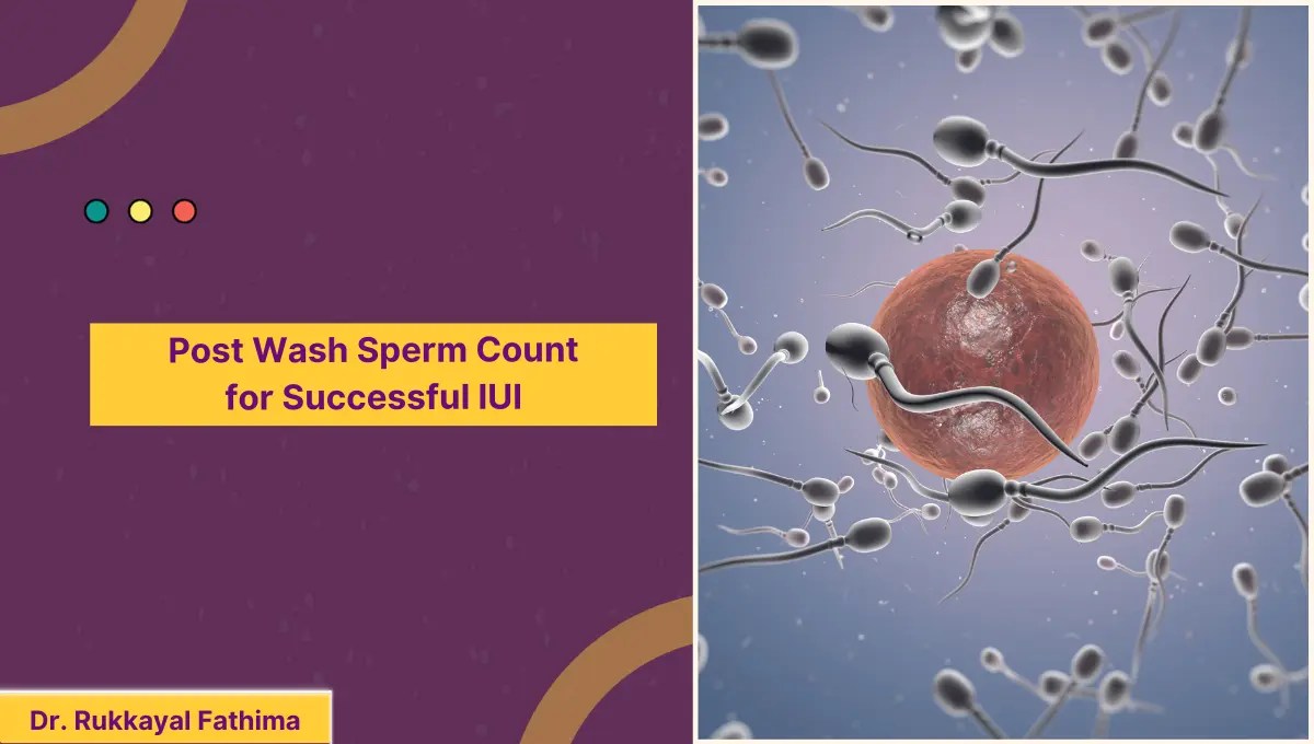 Post Wash Sperm Count for Successful IUI An Optimal Count