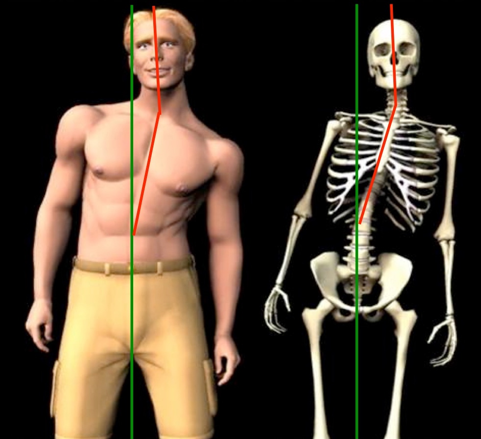 Two Predisposing Causes Of Back Pain Everyone Needs To Know About - Dr. Ryan Hamm