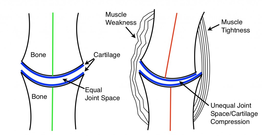 Alignment Dr. Ryan Hamm