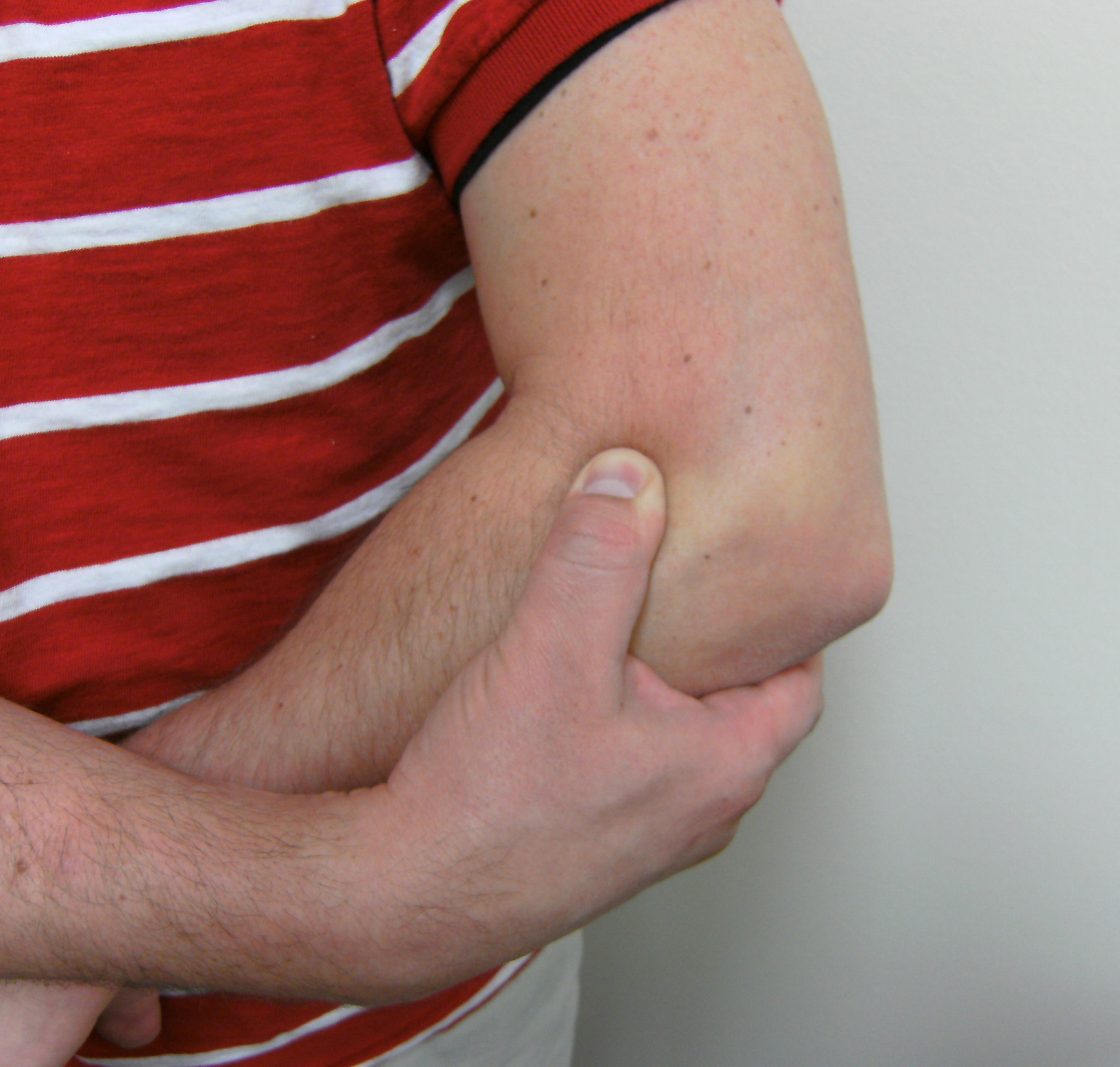Little Known Ways to Resolve and Prevent Tennis and Golfer’s Elbow