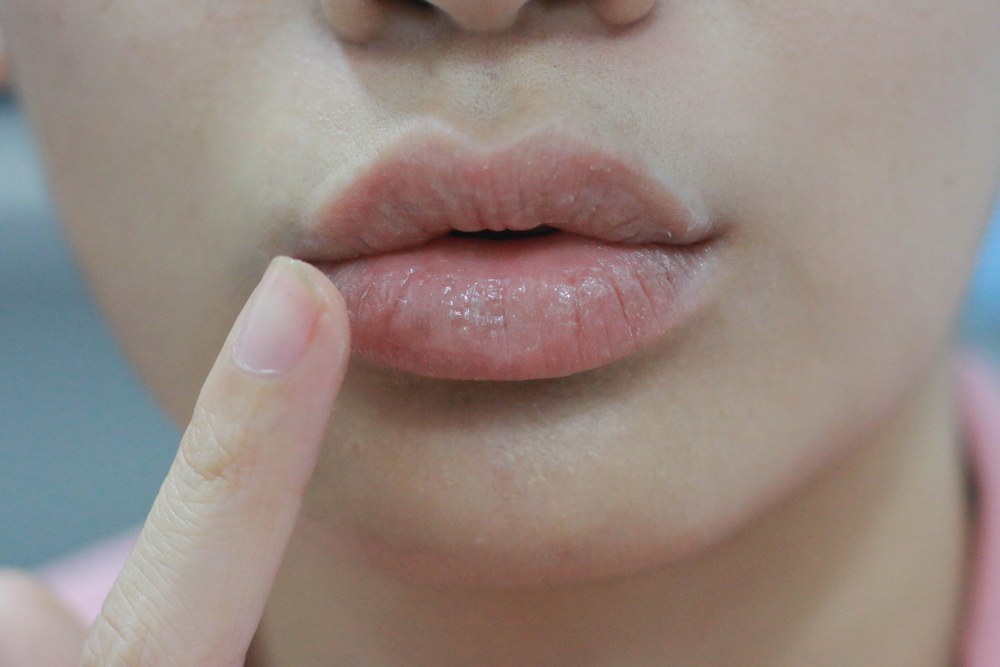 Best Lip Care Tips for Dry Lips Achieving Healthy and Hydrated Lips