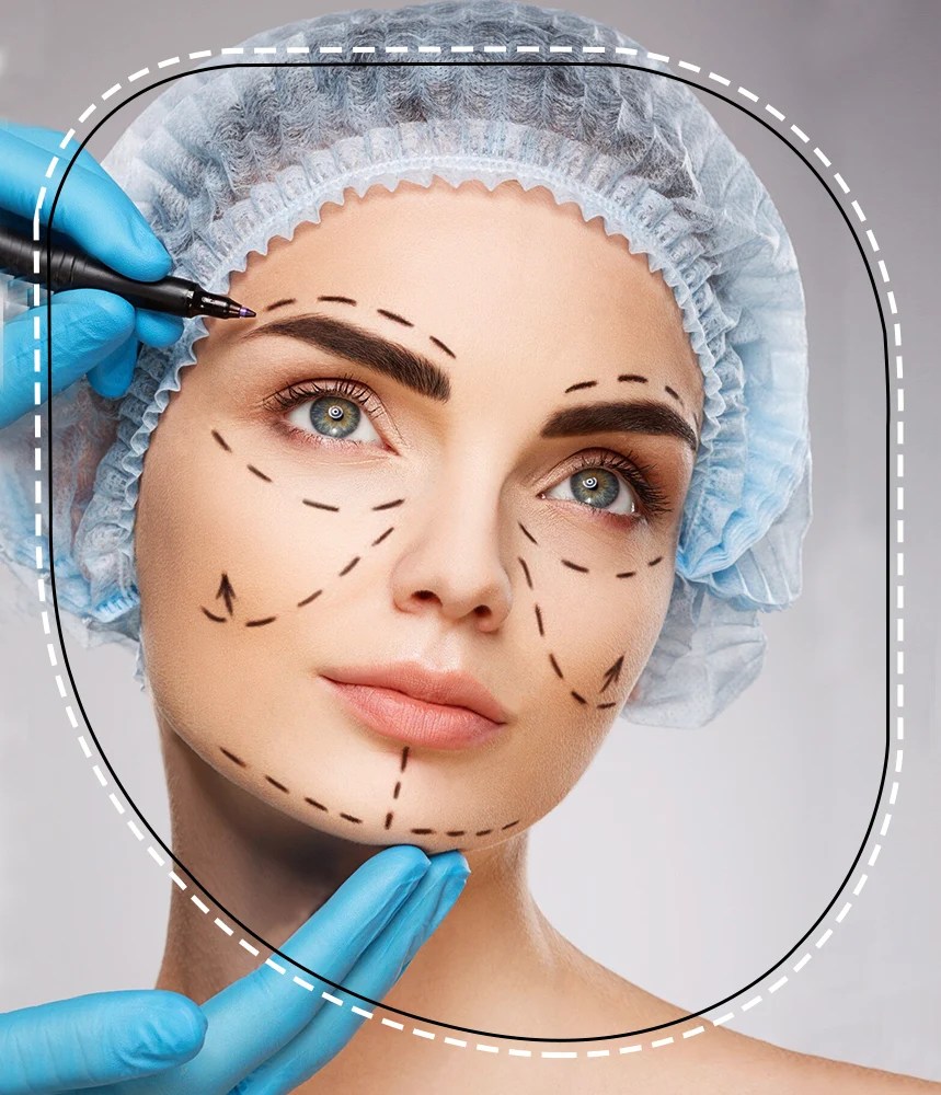 Thread lift Dr Sajjas Clinic in Tirupati