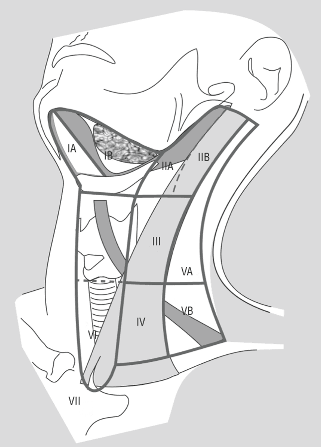 Classifications of Neck Dissection ENT, Head & Neck