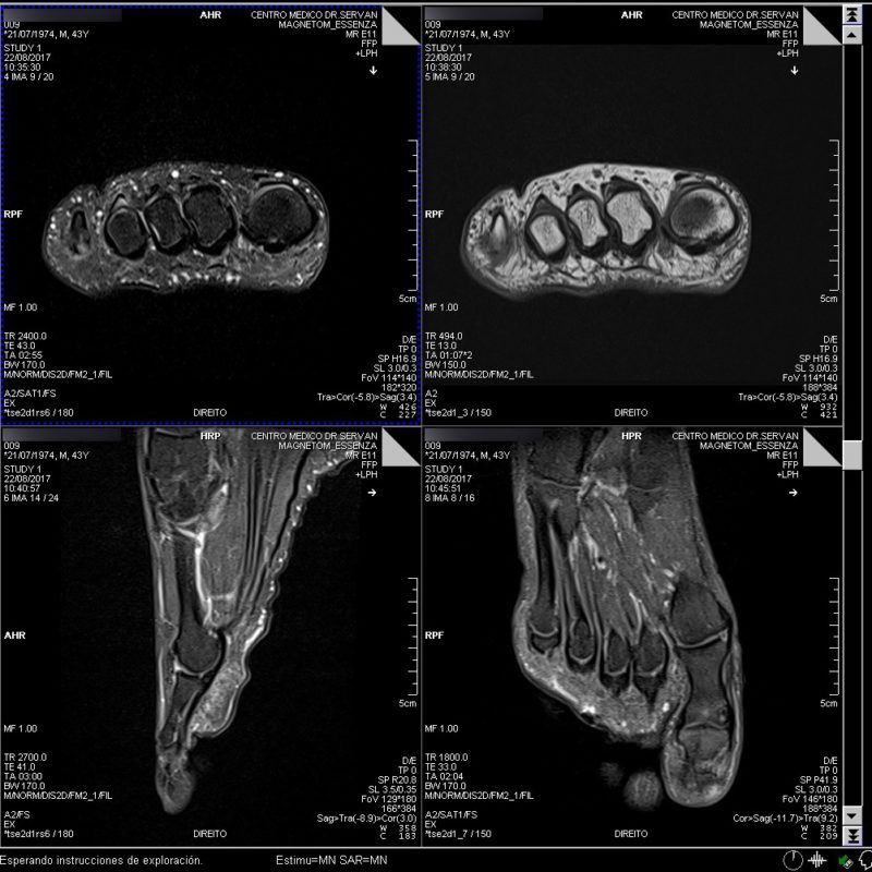 Resonancia Magnética Pie Centro Médico Dr. Serván