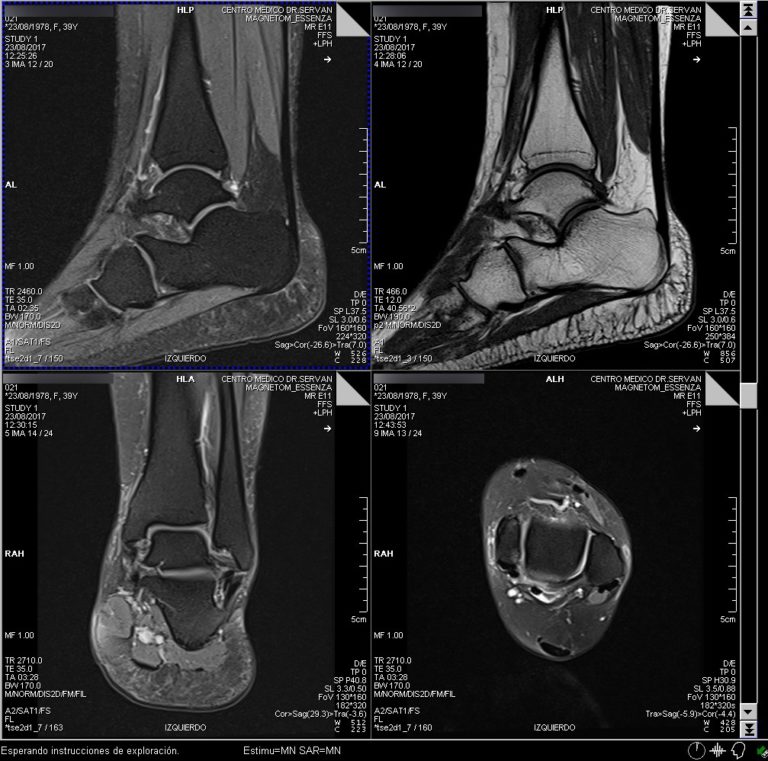 Resonancia Magnética Tobillo Centro Médico Dr. Serván