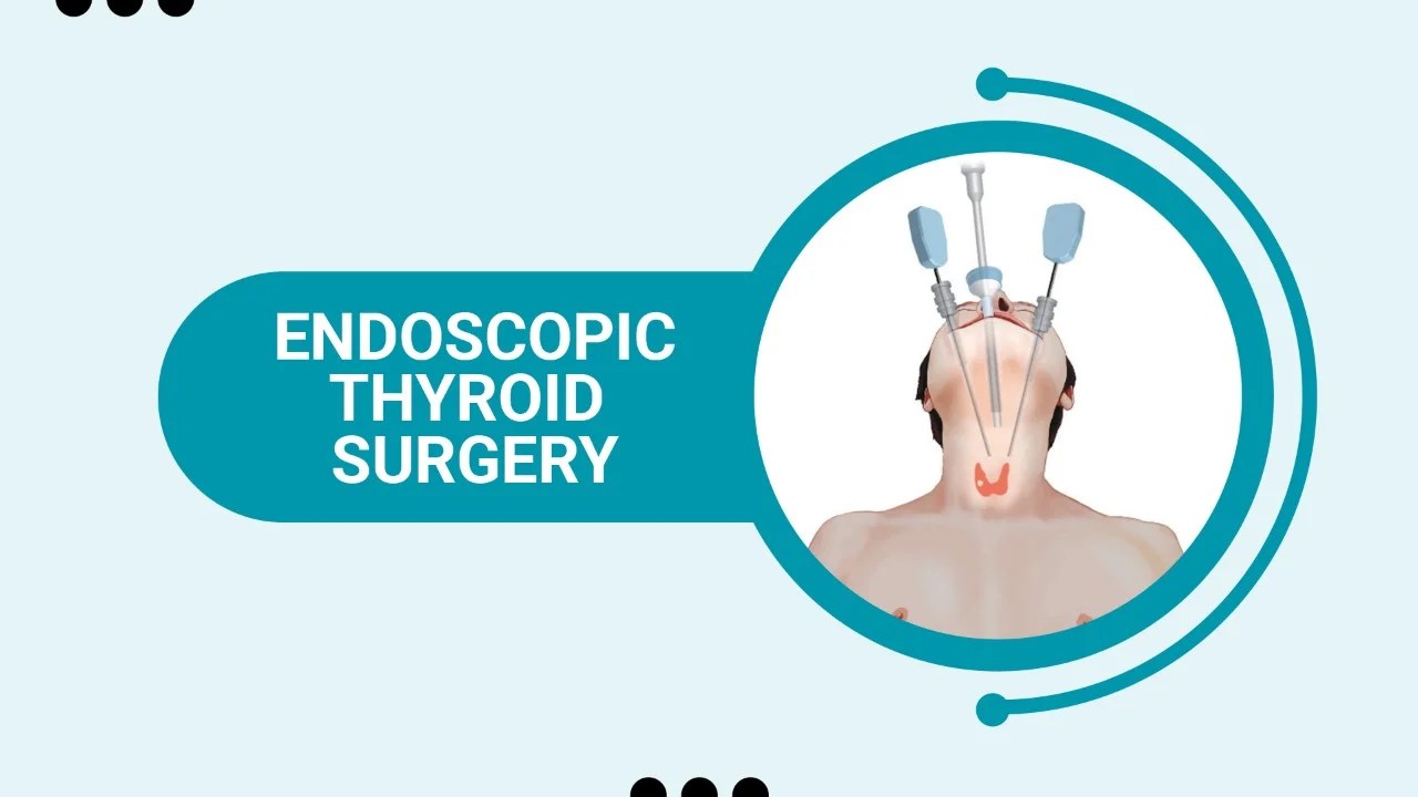 Endoscopic Thyroid surgery