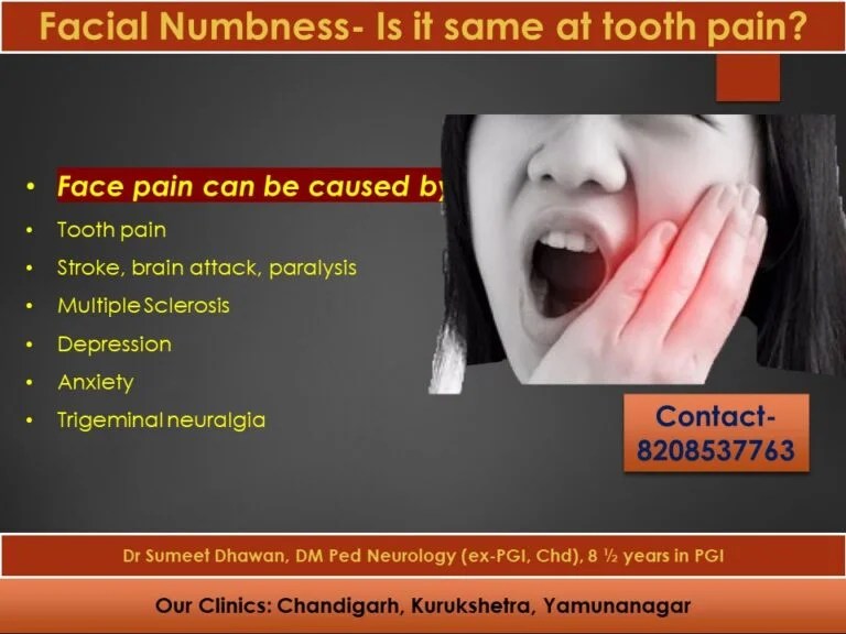 Facial Numbness Is it same at tooth pain? Dr Sumeet Dhawan