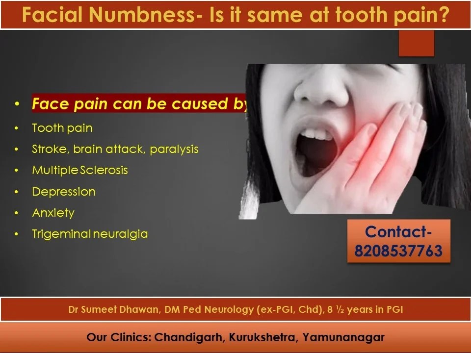 Facial Numbness Is it same at tooth pain? Dr Sumeet Dhawan