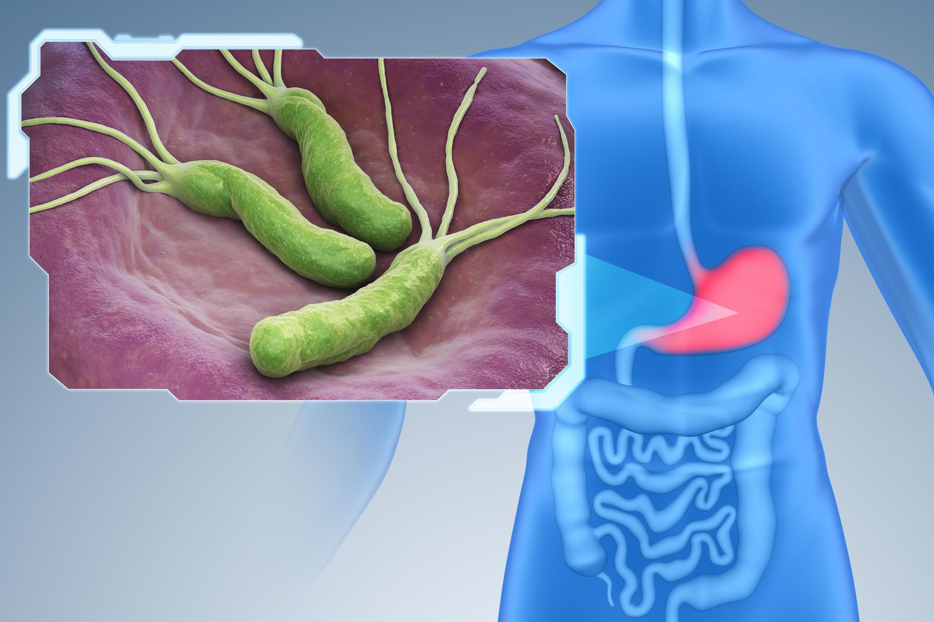 H Pylori Dr.Tathed's Homeopathy