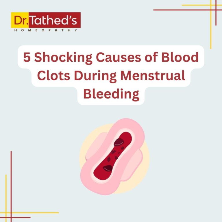 5 Shocking Causes of Blood Clots During Menstrual Bleeding and How