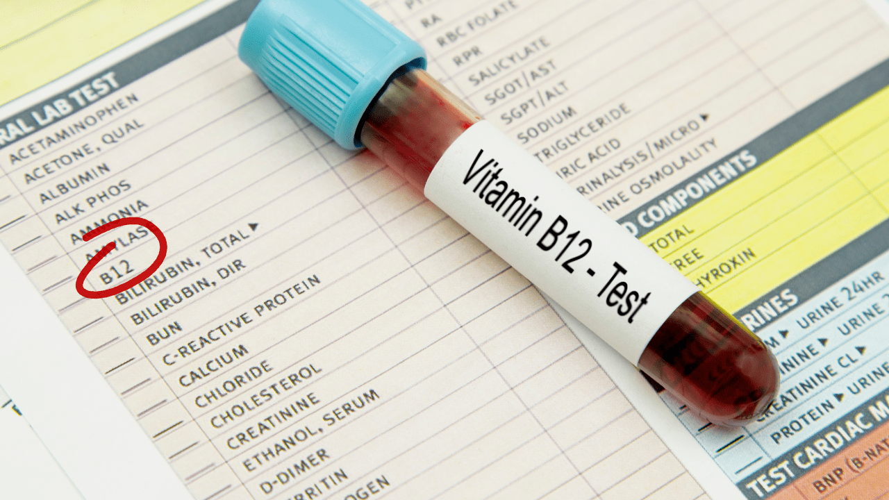 Causes, diagnosis, and treatment of vitamin B12 deficiency Doctor