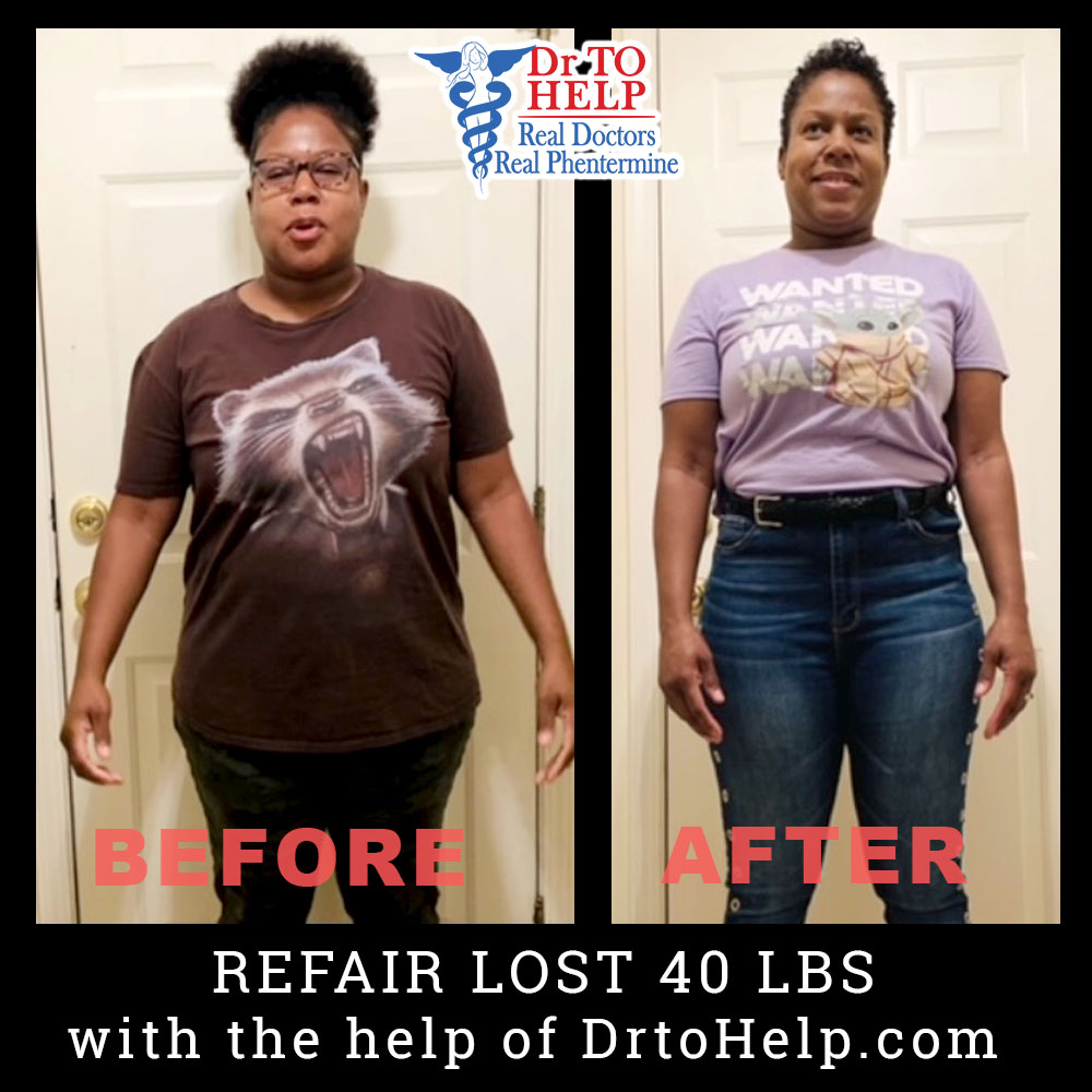 List 93+ Pictures Before And After Phentermine Side Effects Completed