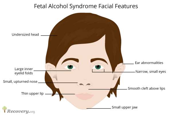 Dangers Of Drinking While Pregnant Pregnancy & Alcohol