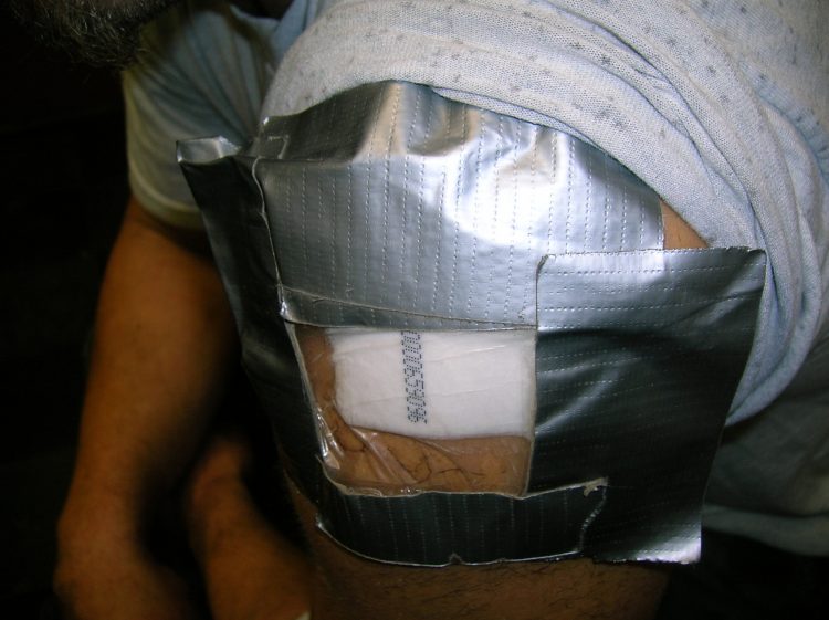 Determining Tampers / Adulterations Drug Patch