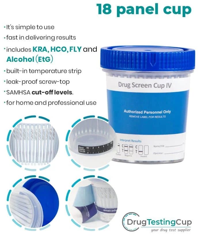 normal urine test results chart nathanielknoerush biokimia dasar urin