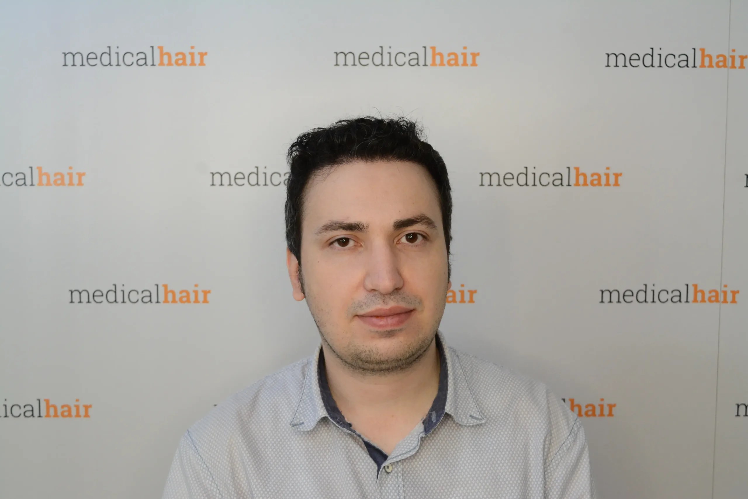 Before and Afters Dr. Ulusan Medical Hair Clinic