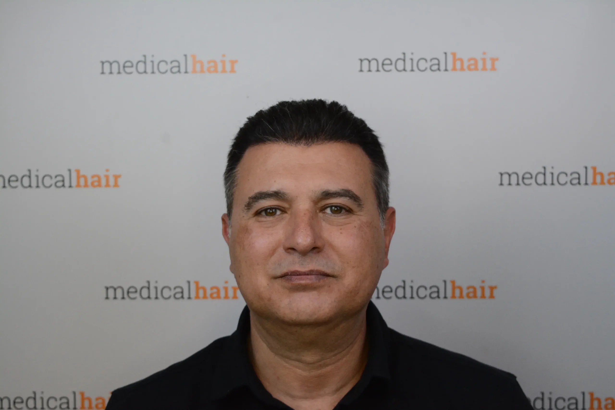 Dr. Ulusan FUE Dr. Ulusan Medical Hair Clinic