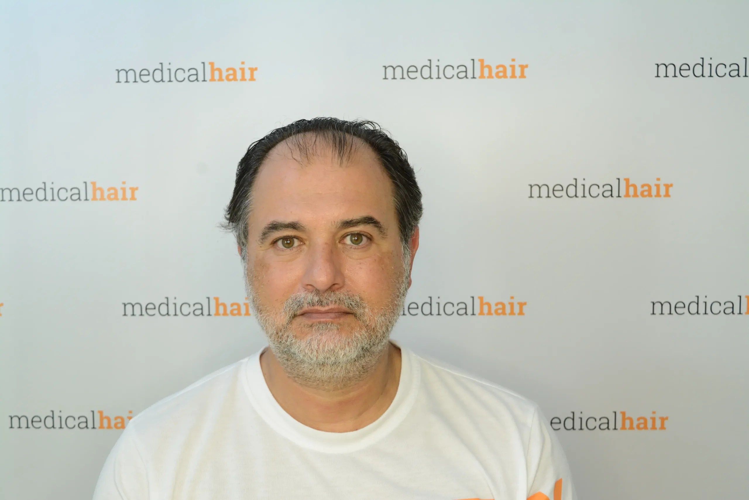 Dr. Ulusan FUE Dr. Ulusan Medical Hair Clinic