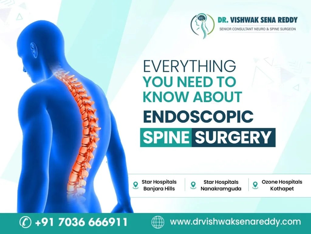 Everything You Need To Know About Endoscopic Spine Surgery