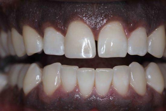 COMPOSITE DENTAL IMPLANT SPECIALITY CENTRE