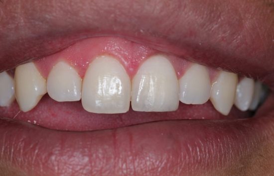 COMPOSITE DENTAL IMPLANT SPECIALITY CENTRE