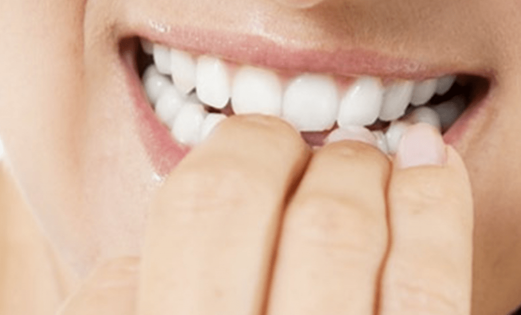 Ask Dr. Whitlock What’s so bad about nail biting? Dr. Whitlock