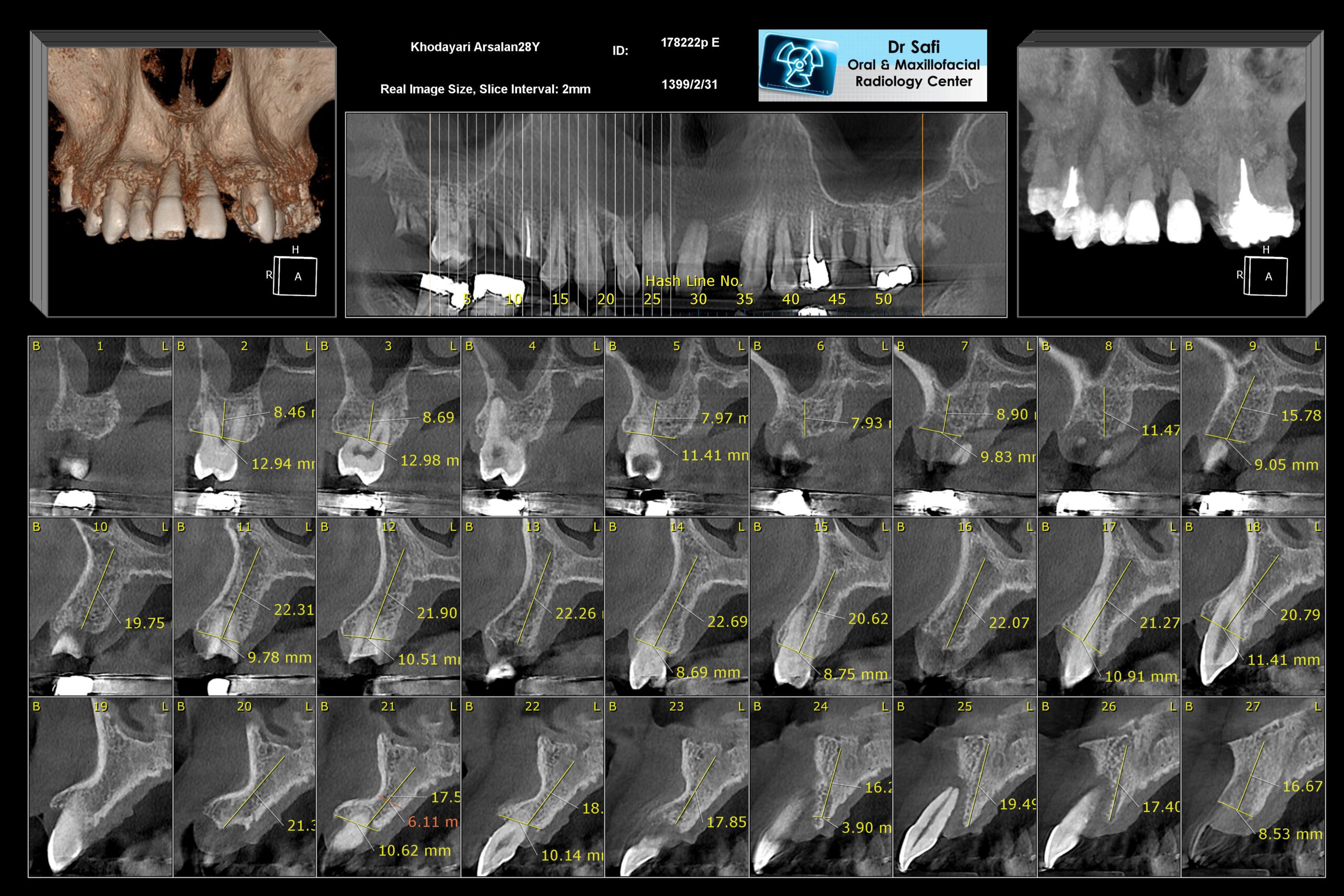 Cone Beam Computed Tomography (CBCT) Specialized Radiology Services