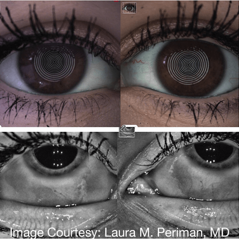 Drops & Eyelash Cosmetics with Laura M. Periman, MD
