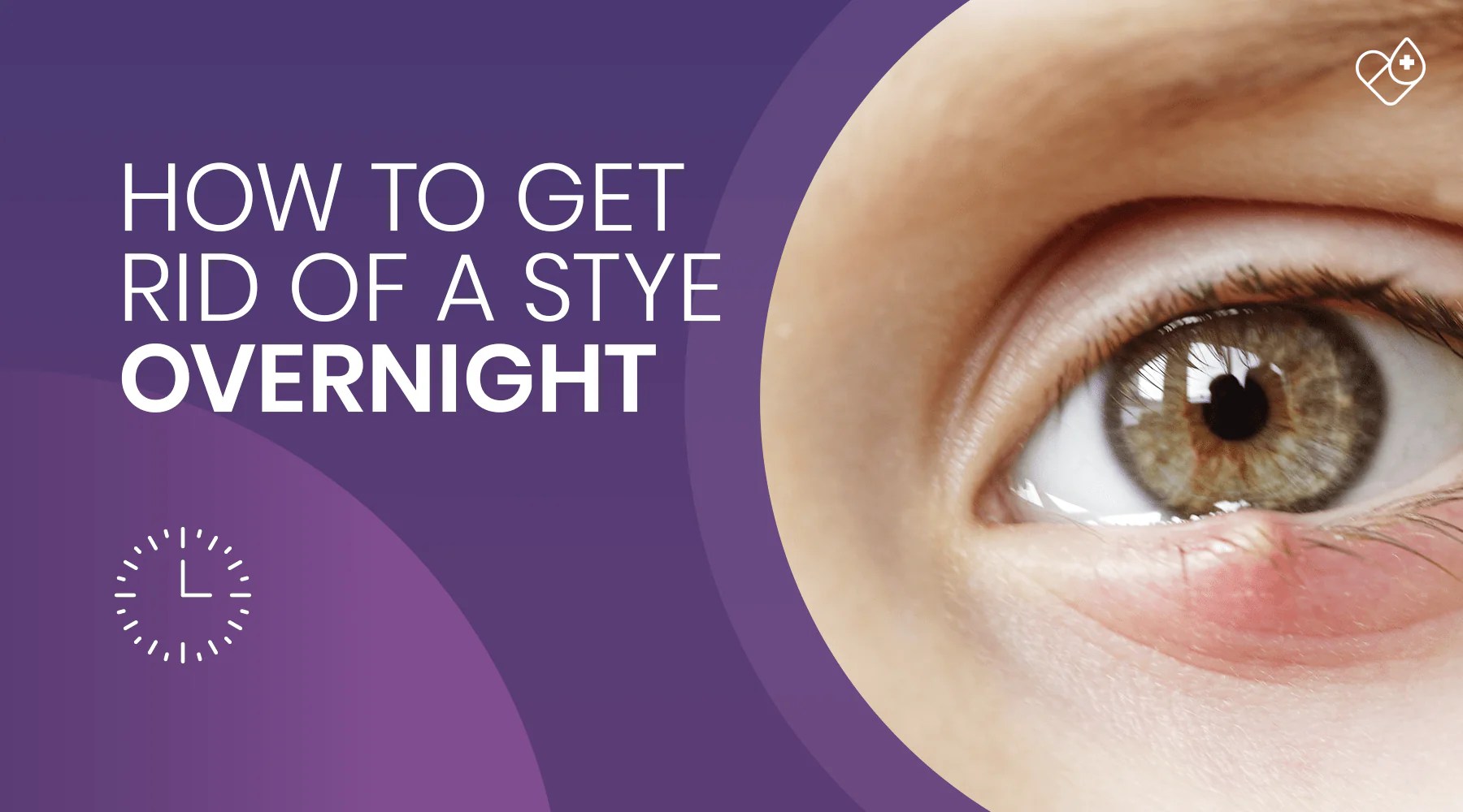 How to get rid of a stye overnight