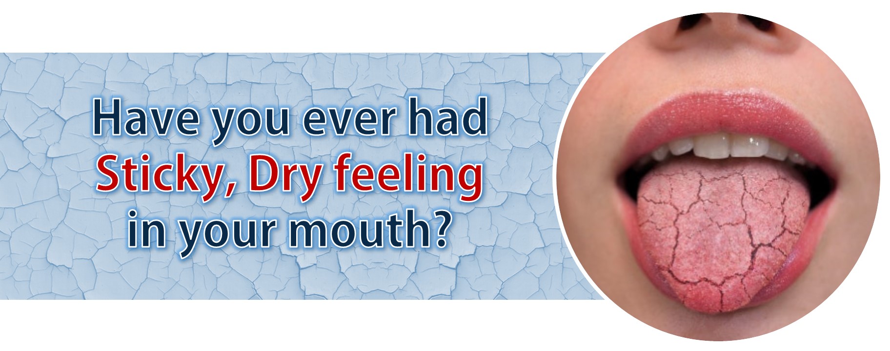 DryMouthPro Instant Dry Mouth Relief