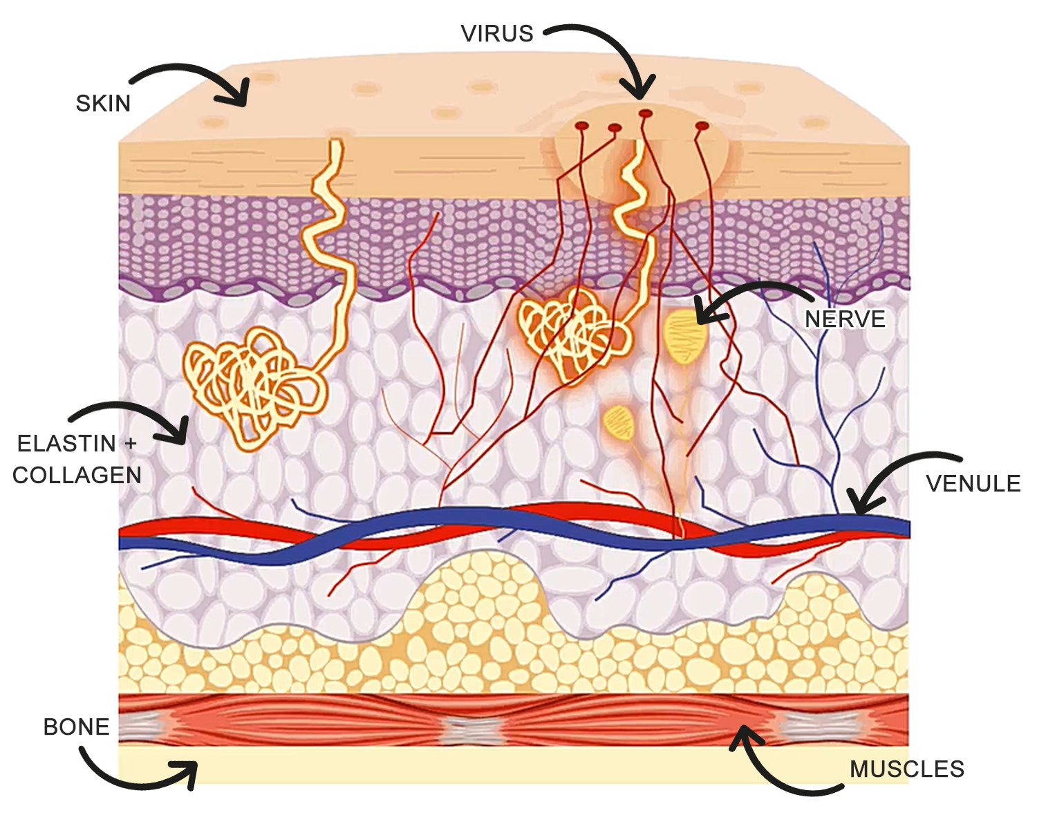 Warts Dubai Podiatry Centre